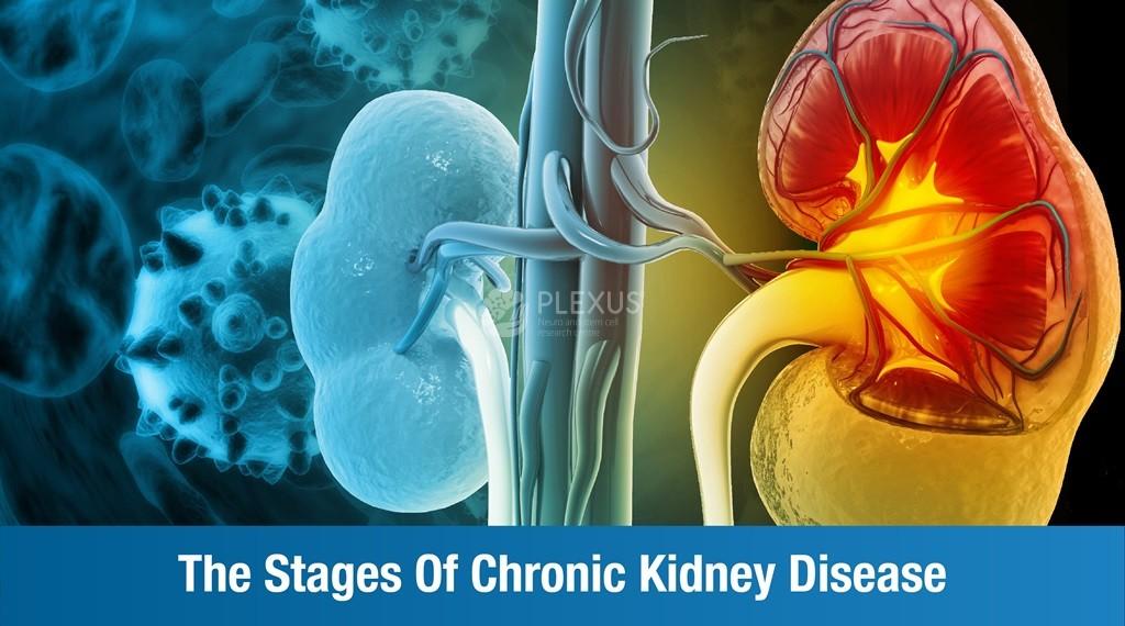 The 5 Stages of CKD