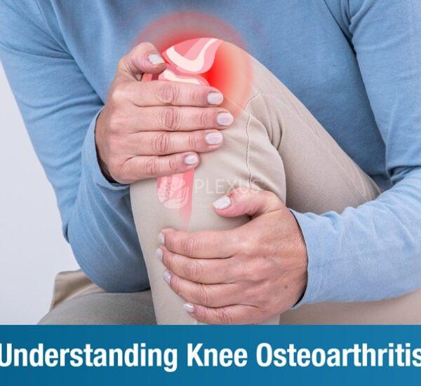 Understanding Knee Osteoarthritis