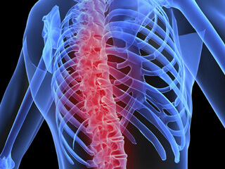Coping With Spinal Cord Injury