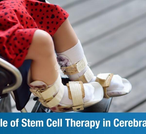 The Role of Stem Cell Therapy in Cerebral Palsy
