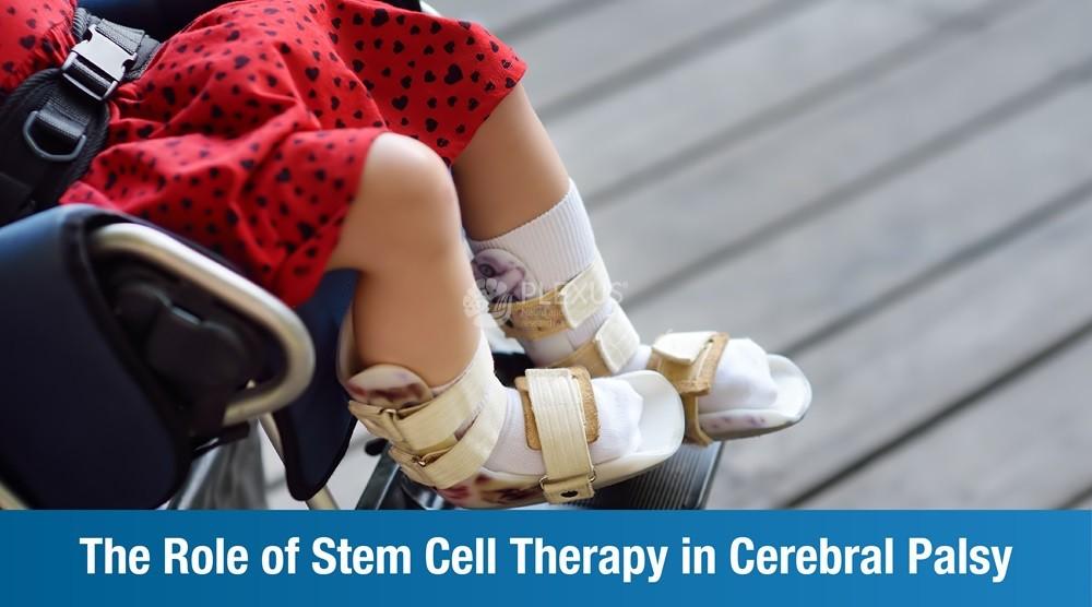 The Role of Stem Cell Therapy in Cerebral Palsy