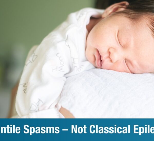 Infantile Spasms: Symptoms, Causes, and Treatment