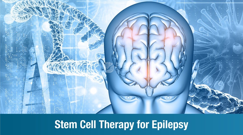 Stem Cell Therapy for Epilepsy