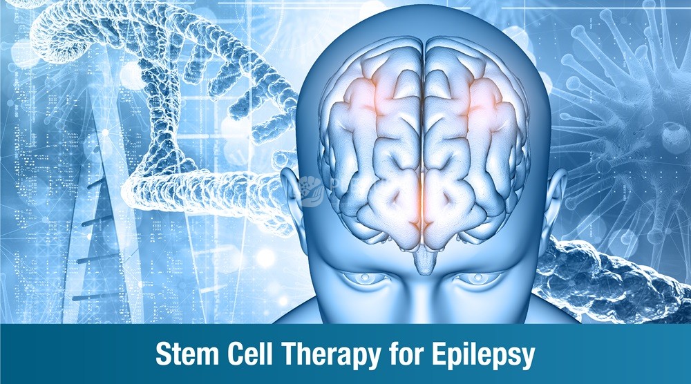 Cell Therapy for Epilepsy