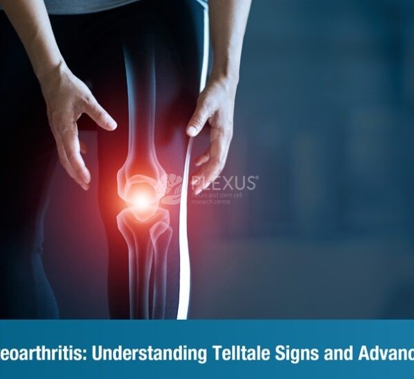 Diagnosing Osteoarthritis: Understanding Telltale Signs and Advanced Diagnostics