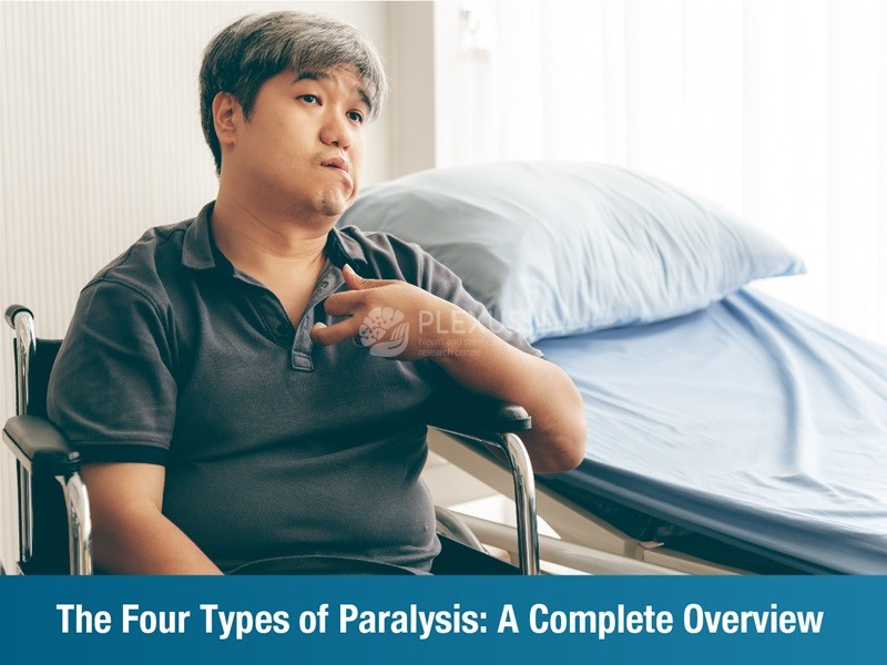 The Four Types of Paralysis: A Complete Overview