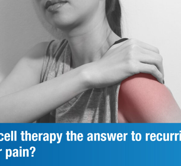 Overcoming Shoulder Pain the Right Way with Stem Cell Therapy