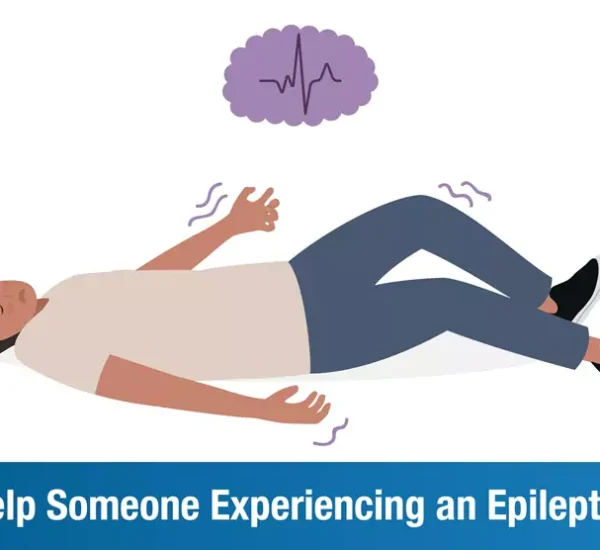 How to Help Someone Experiencing an Epileptic Seizure