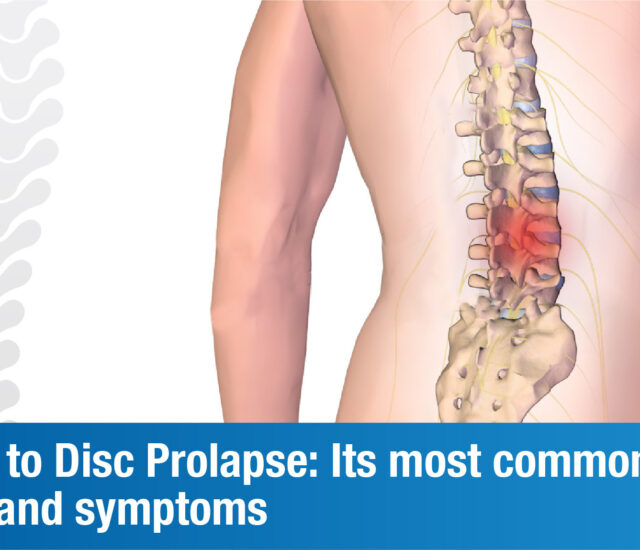 Everything you need to know about Disc Prolapse