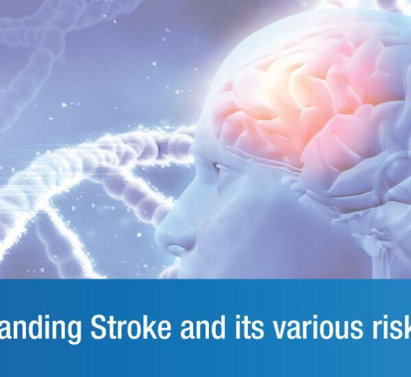 Risk Factors for Stroke: What To Keep an Eye Out For