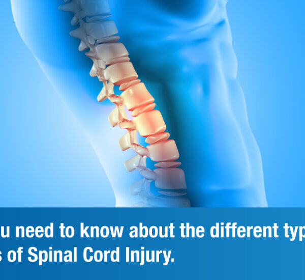 Decoding Spinal Cord Injury — Its Types and Levels