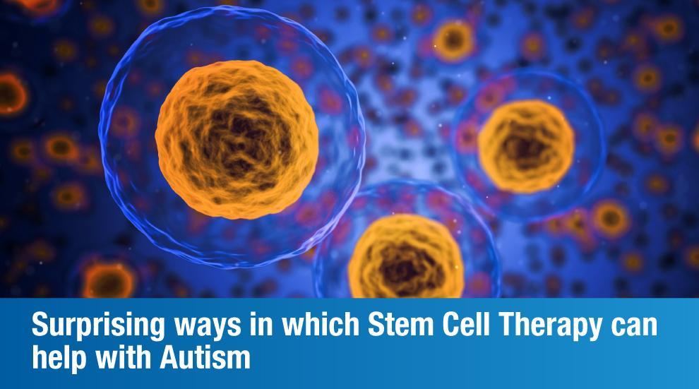 Here’s Everything You Need To Know About Stem Cell Therapy for Autism