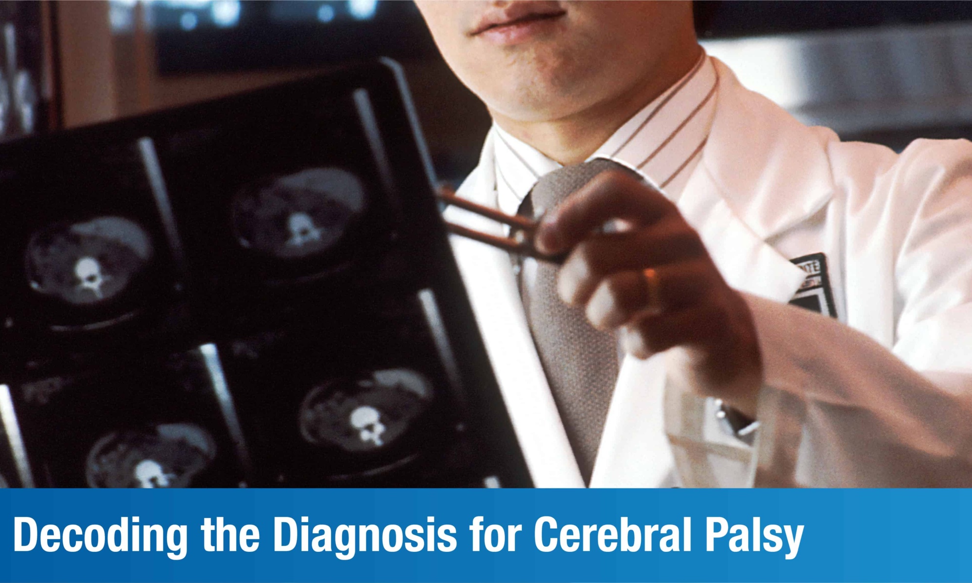 Learn About the Diagnosis for Cerebral Palsy