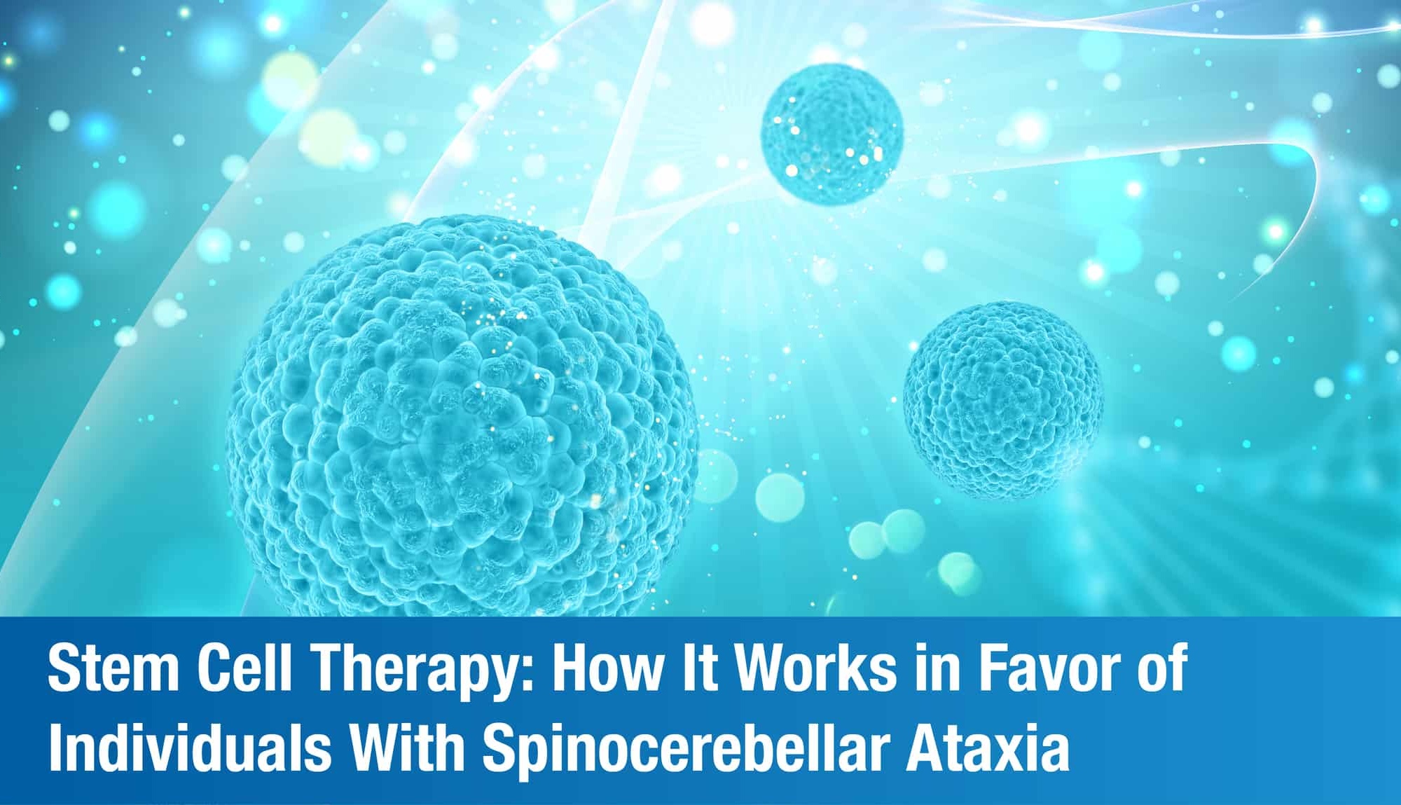 How Beneficial is Stem Cell Therapy for Spinocerebellar Ataxia?