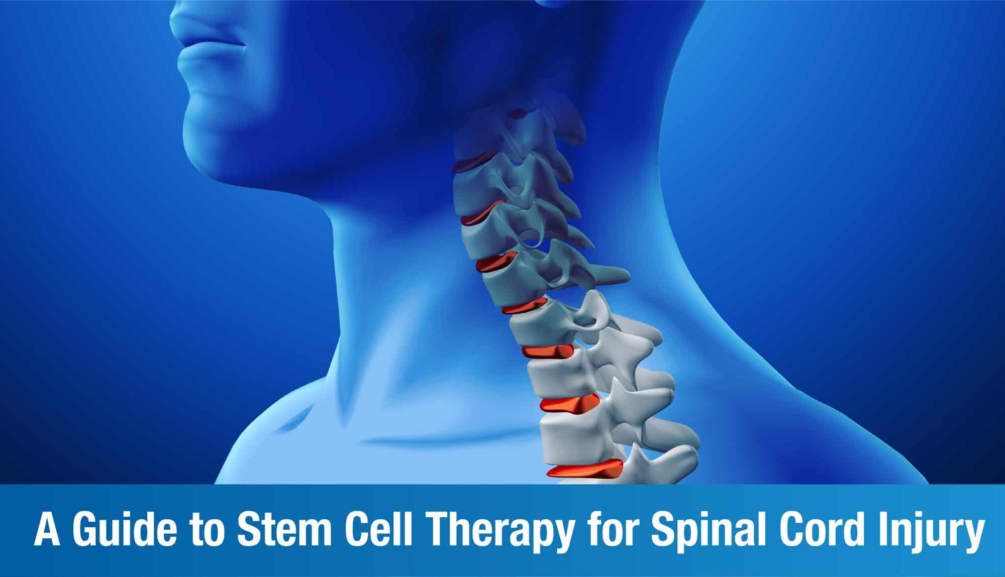 Stem Cell Therapy for Spinal Cord Injury: All You Need To Know