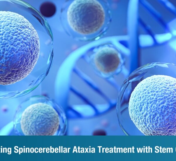 Revolutionizing Spinocerebellar Ataxia Treatment with Stem Cell Therapy