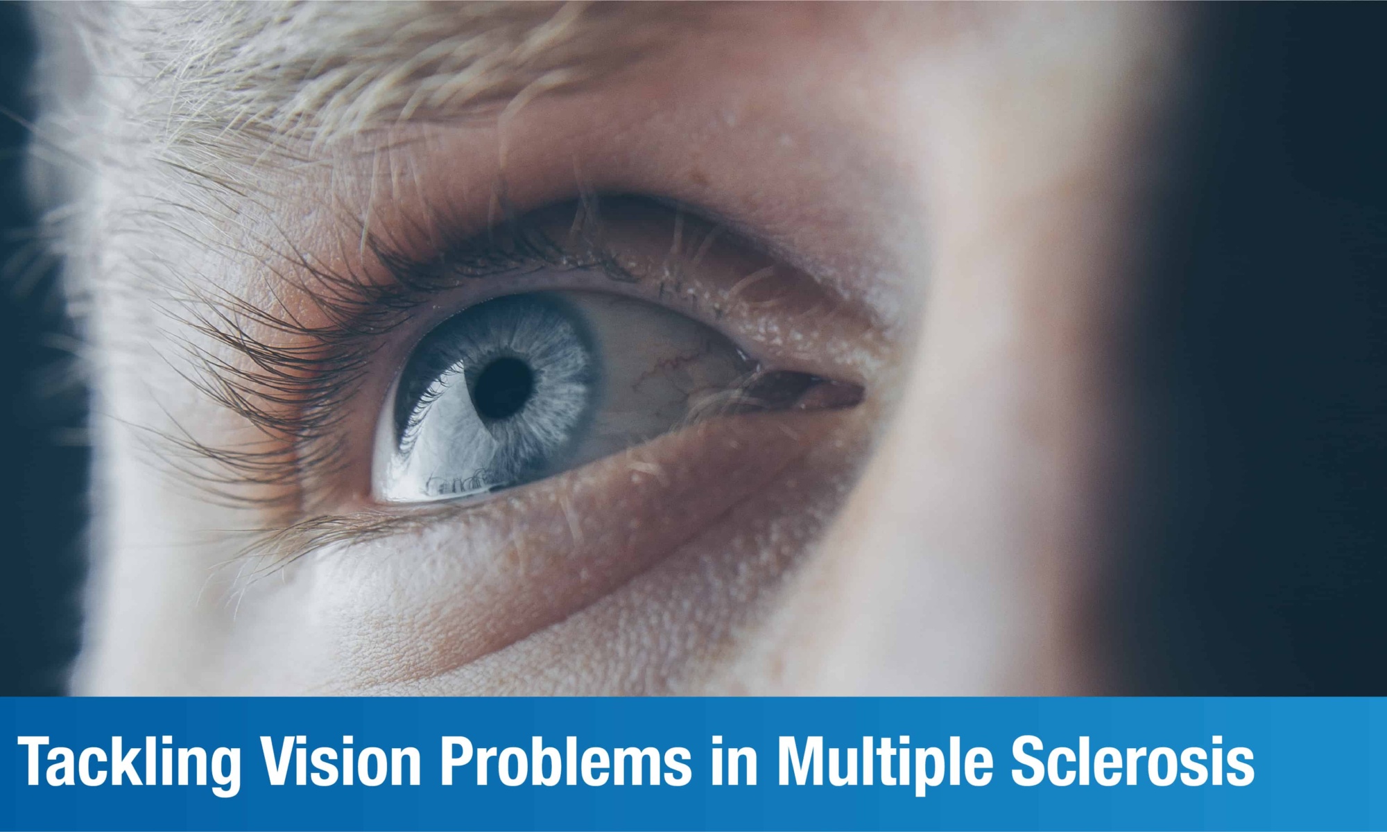 How to Deal with Vision Disturbances in Multiple Sclerosis? | Plexus