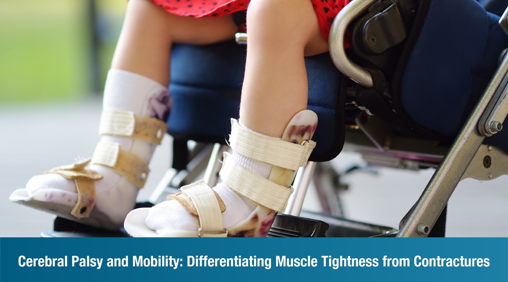 Cerebral Palsy and Mobility: Differentiating Muscle Tightness from Contractures