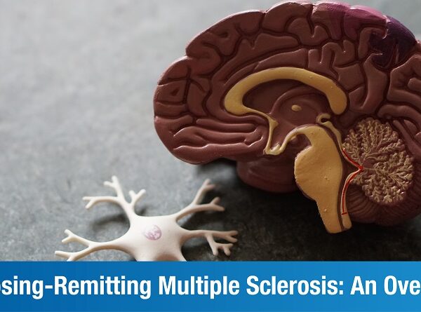 An Introduction To Relapsing-Remitting Multiple Sclerosis