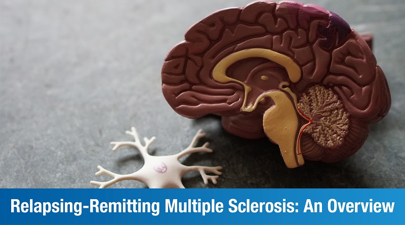 An Introduction To Relapsing-Remitting Multiple Sclerosis