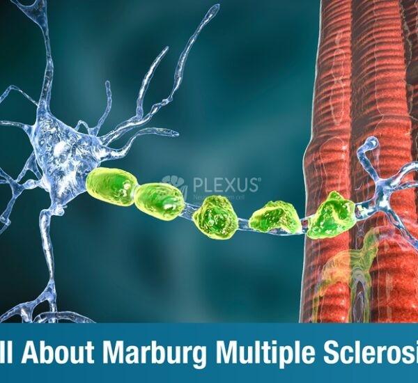 All About Marburg Multiple Sclerosis: Symptoms, Diagnosis, and Treatment Strategies