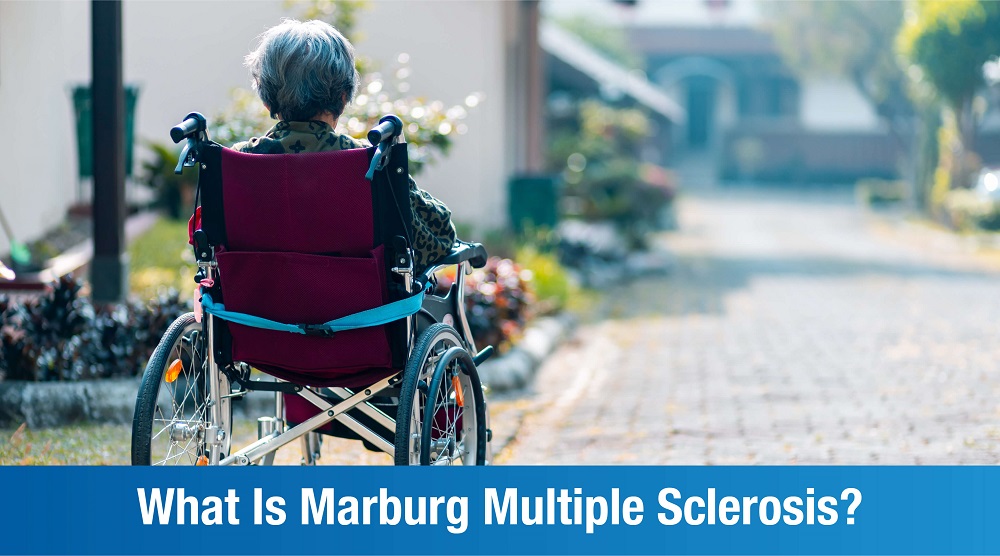 Marburg Multiple Sclerosis: An Introduction