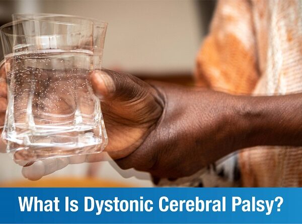 Dystonic Cerebral Palsy – An Overview
