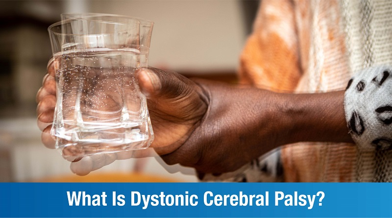 Dystonic Cerebral Palsy – An Overview