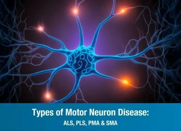 Types of Motor Neuron Disease: ALS, PLS, PMA & SMA