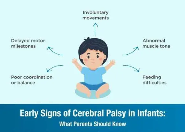 Early Signs of Cerebral Palsy in Infants: What Parents Should Know