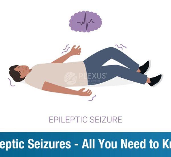 Epileptic Seizures – All You Need to Know