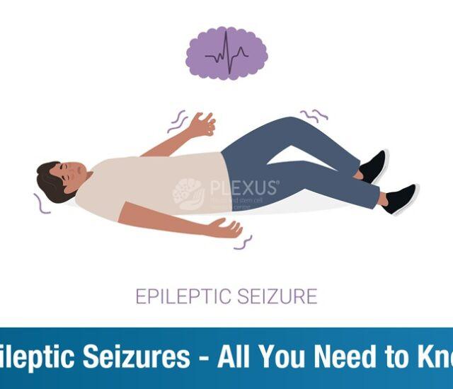 Epileptic Seizures – All You Need to Know