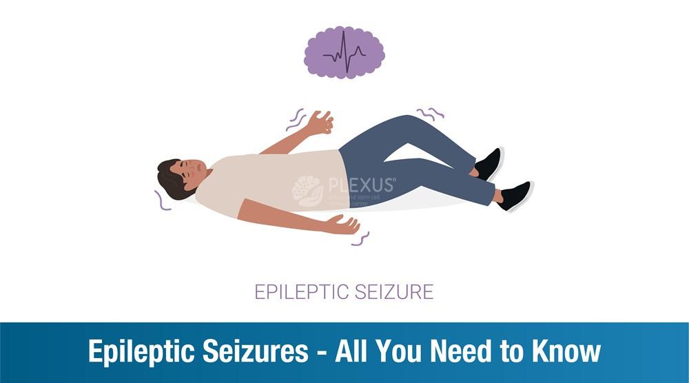 Epileptic Seizures – All You Need to Know