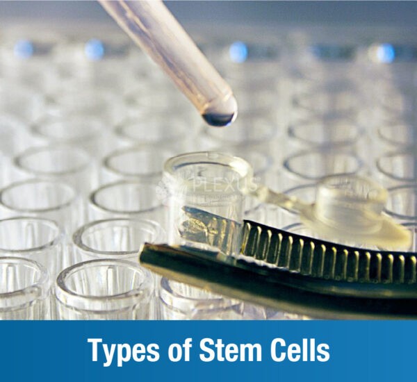Types of Stem Cells