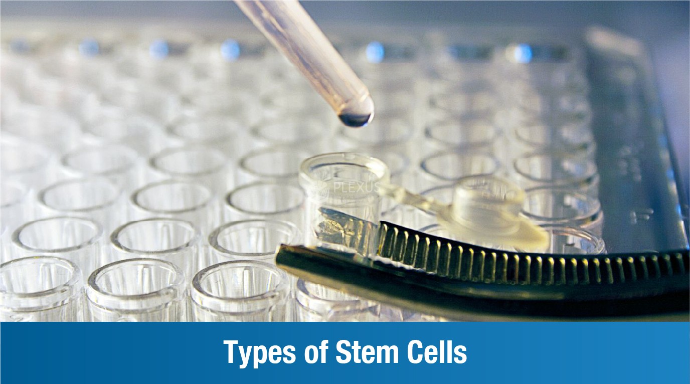 Types of Stem Cells