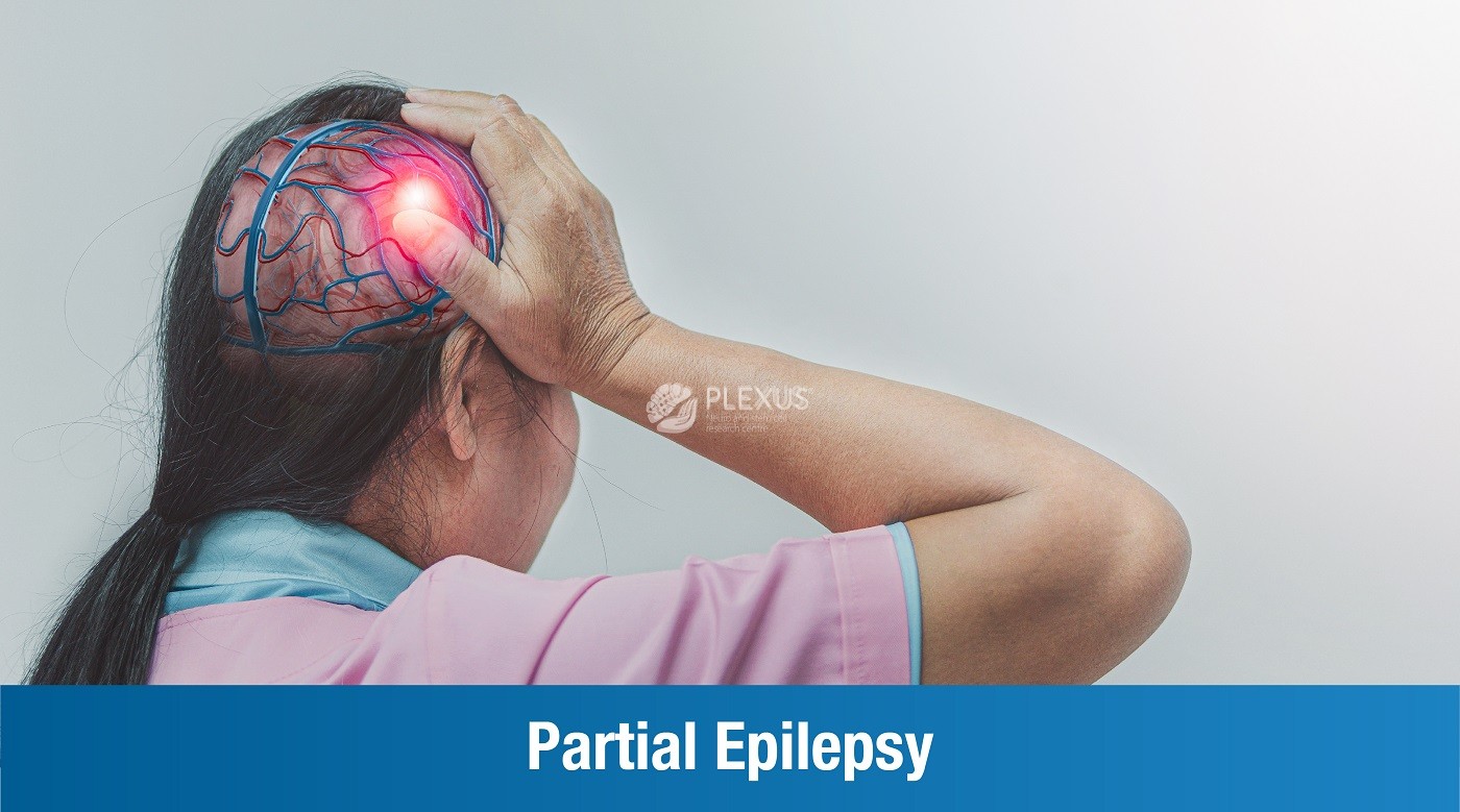 Partial seizures - PLEXUS