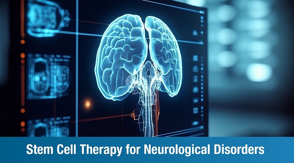 Cell therapy for neurological disorders