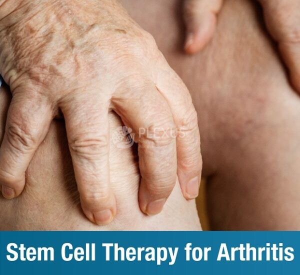 Stem Cell Therapy for Arthritis