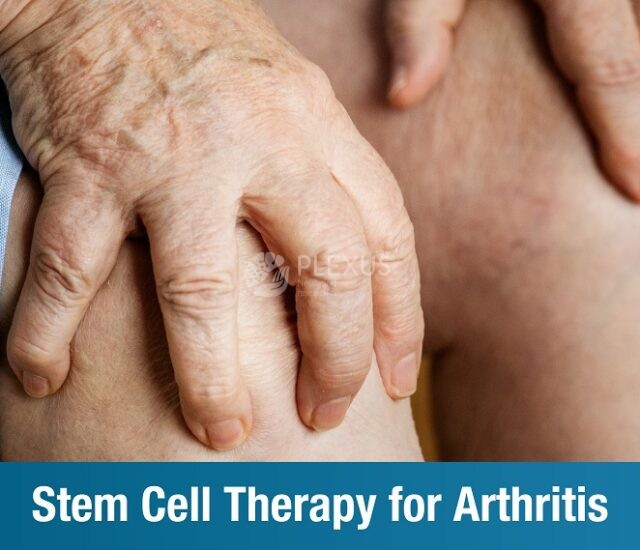 Stem Cell Therapy for Arthritis