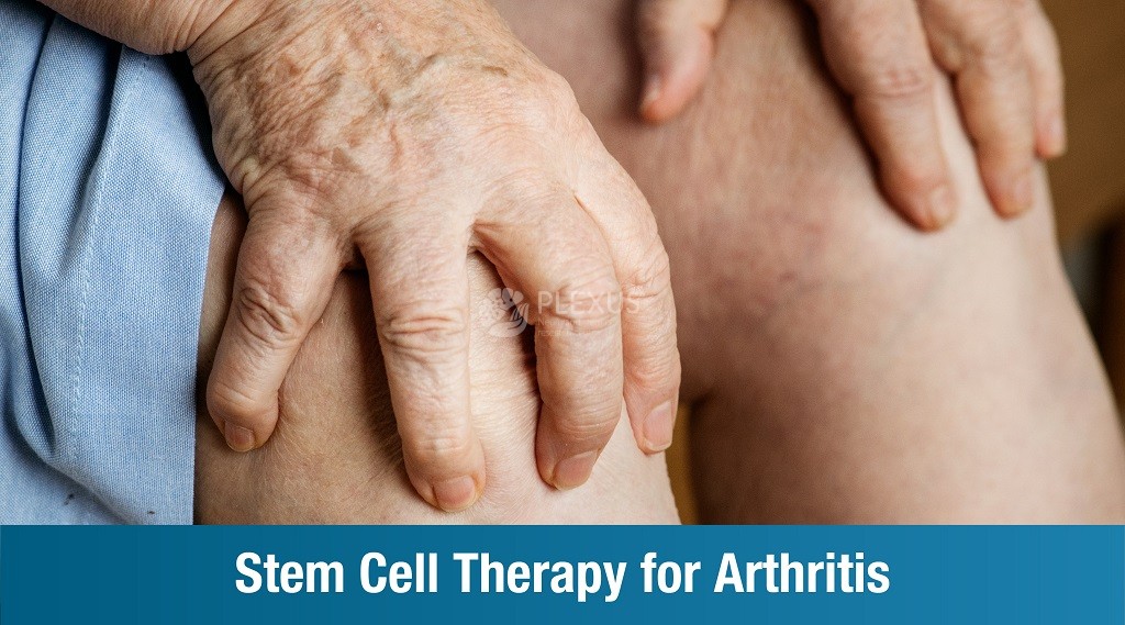 Cell Therapy for Arthritis