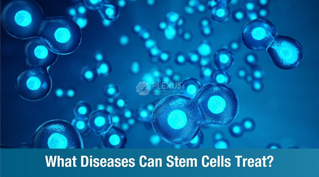 What Diseases Can Stem Cells Treat?