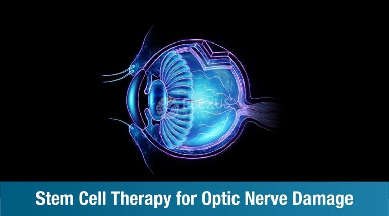 Cell Therapy for Optic Nerve Damage | Plexus