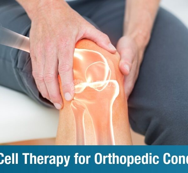 Stem Cell Therapy for Orthopedic Conditions