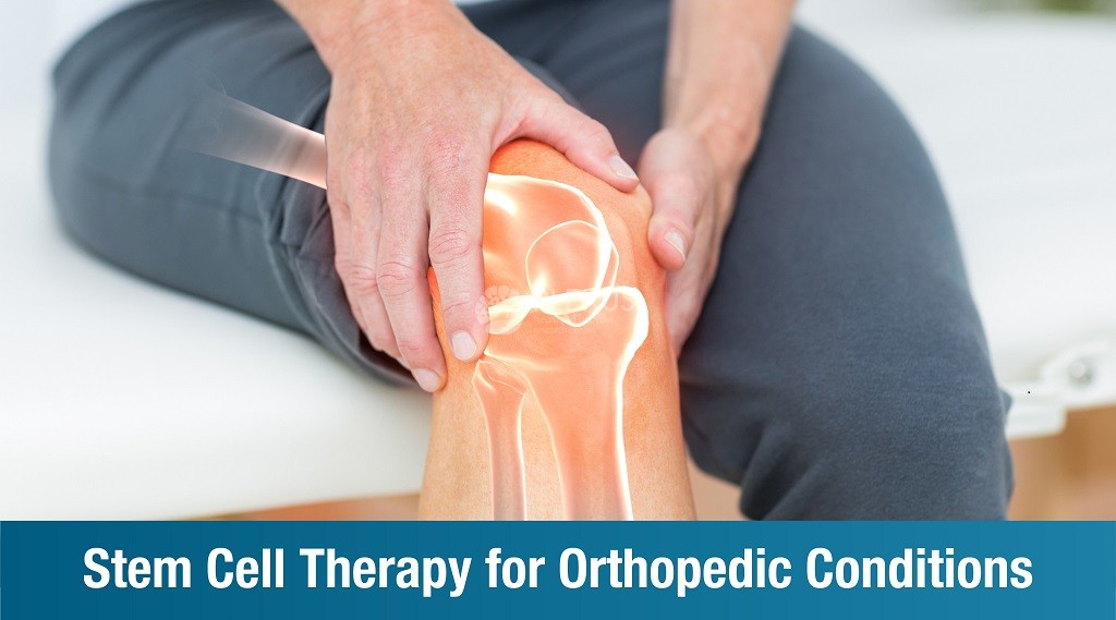 Stem Cell Therapy for Orthopedic Conditions