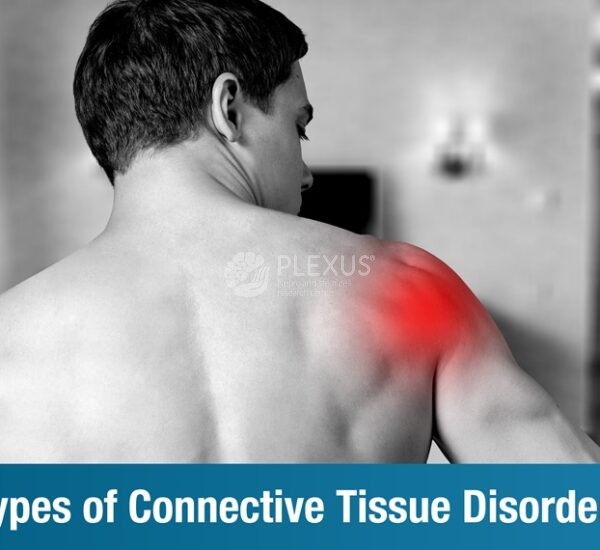 Types of Connective Tissue Disorders – Special focus on mixed connective tissue disorder (MCTD)