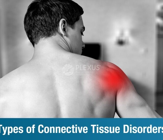 Types of Connective Tissue Disorders – Special focus on mixed connective tissue disorder (MCTD)