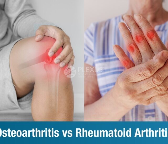 Osteoarthritis vs Rheumatoid Arthritis – Understanding the Differences
