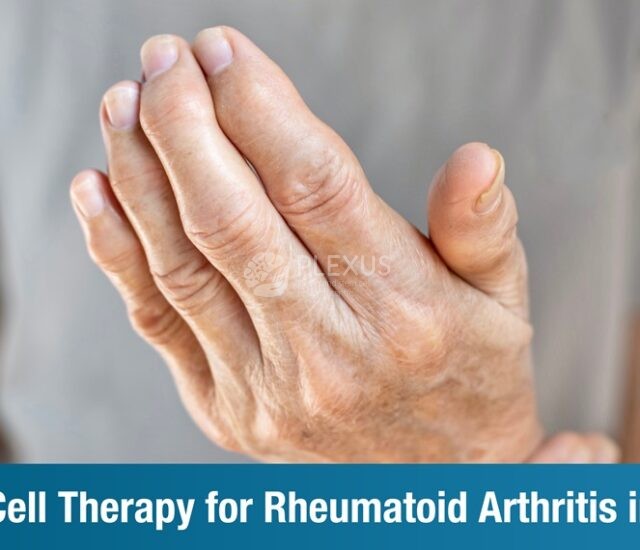 Stem Cell Therapy for Rheumatoid Arthritis in India