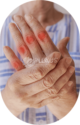 Best Rheumatoid Arthritis