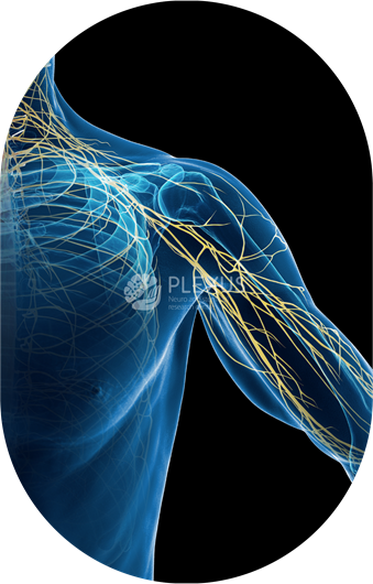 Brachial Plexus Injury treatment